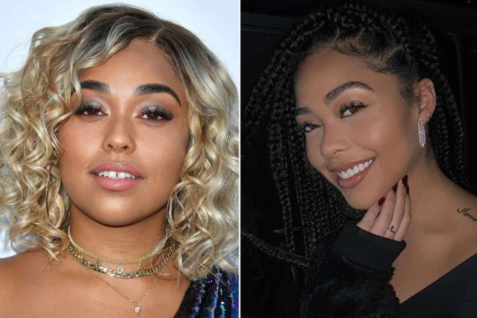 Jordyn Woods veneers