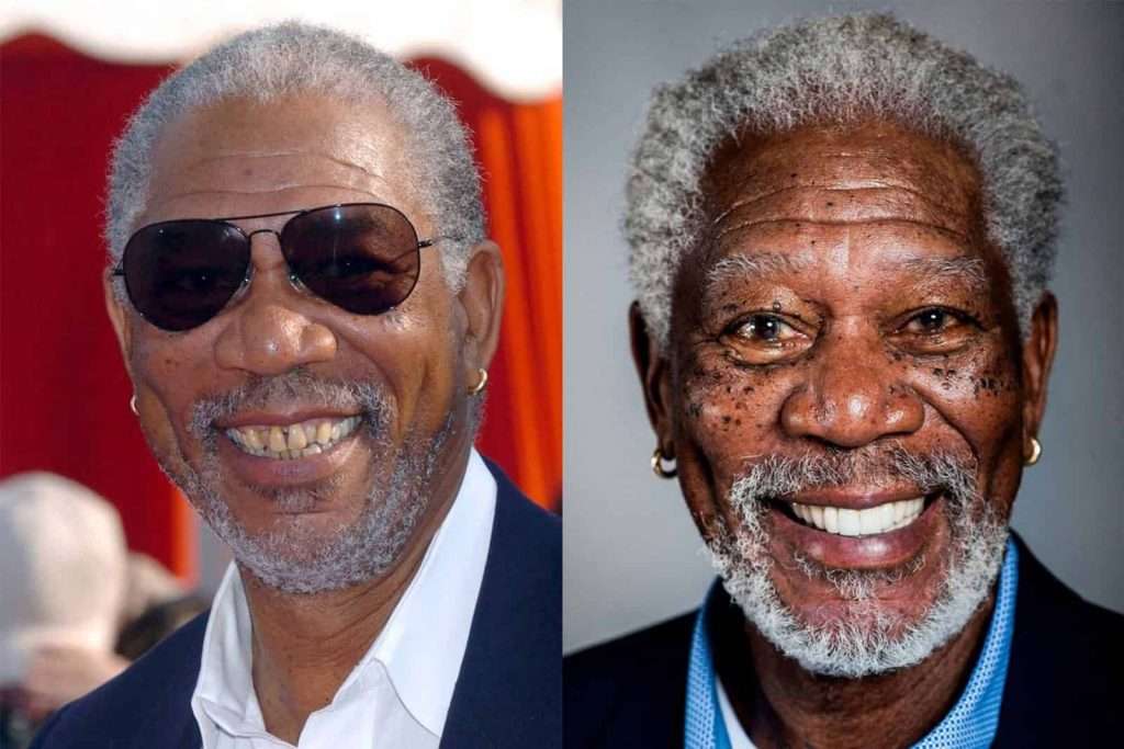 Morgan Freeman veneers