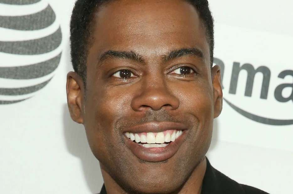 chris rock veneers