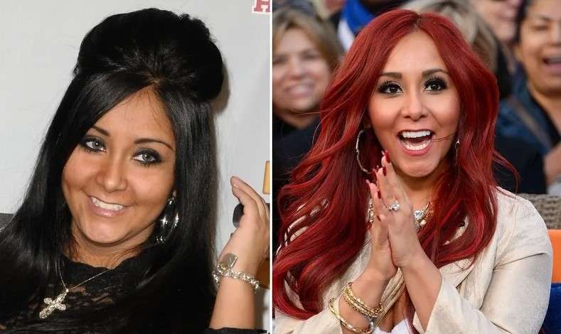 snooki veneers