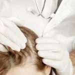 cholesterol and hair health