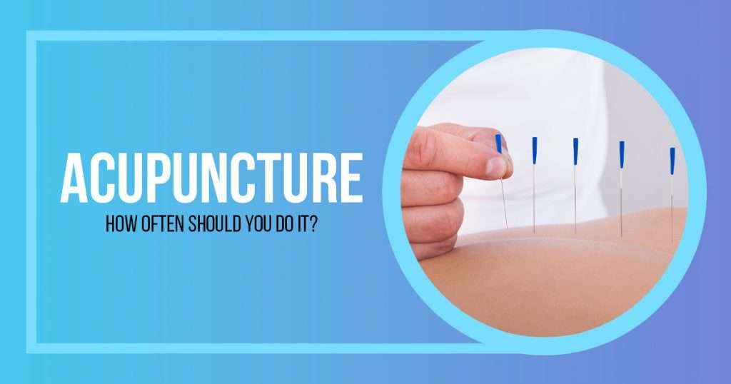 Acupuncture How Often Should You Do It?