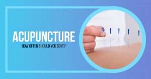 how often should you get acupuncture