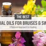 essential oils for bruises