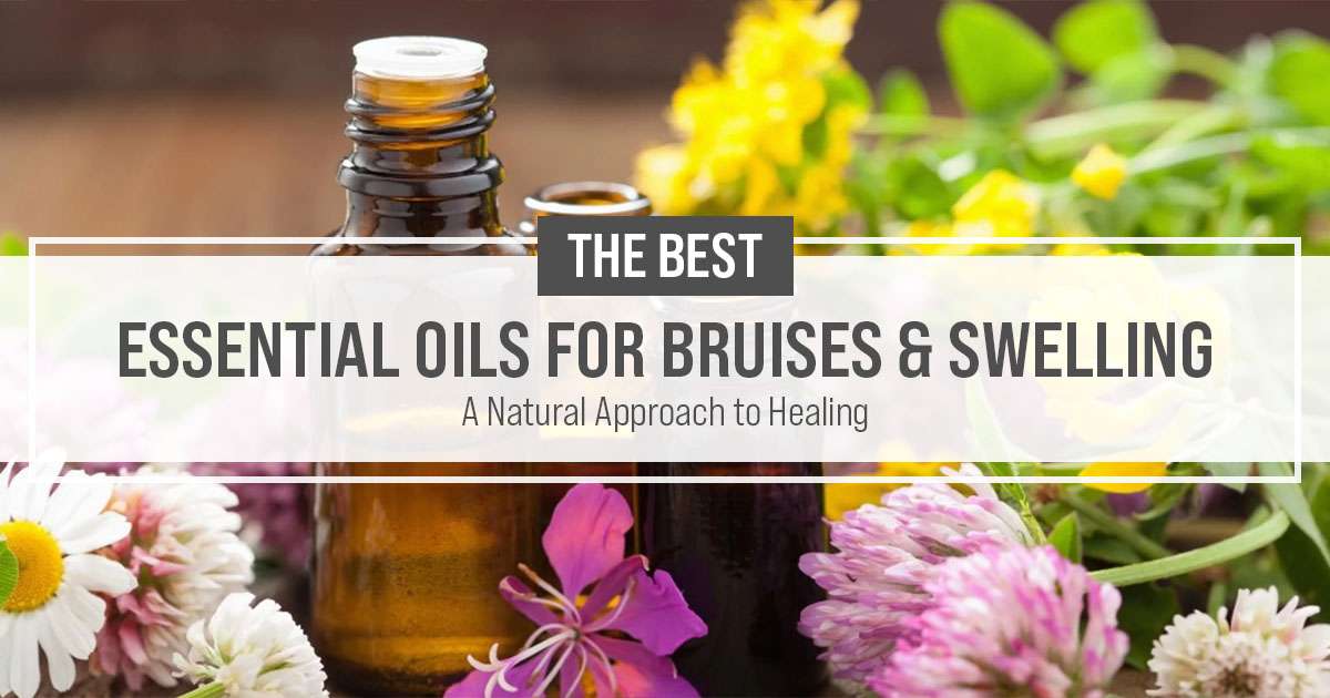 essential oils for bruises