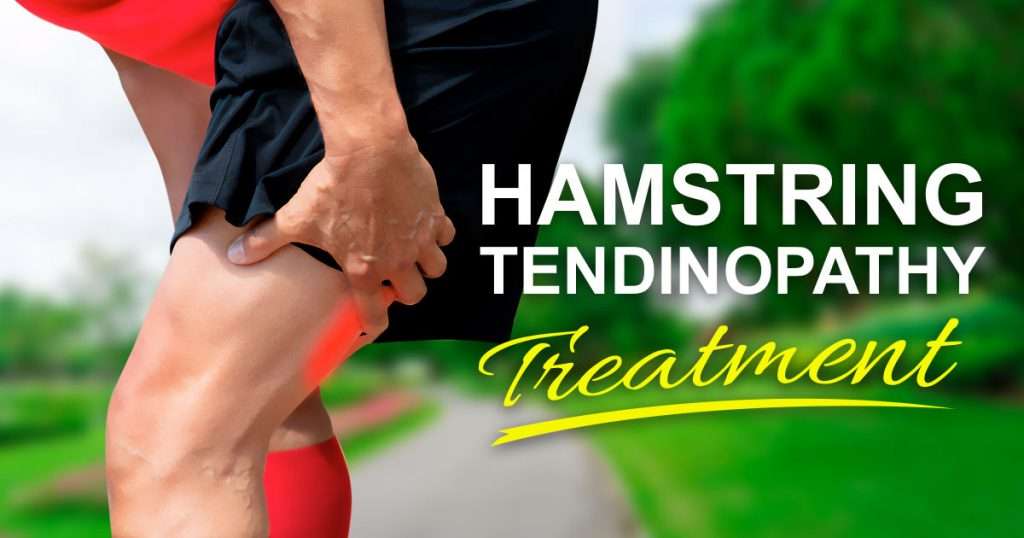 high-hamstring-tendinopathy-treatment