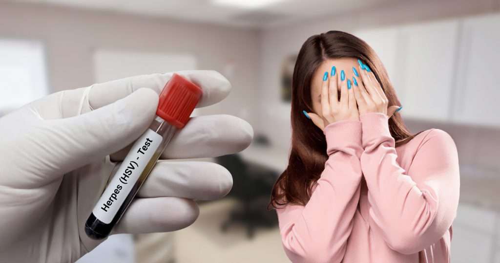 How Long Should I Wait to Get Tested for STDs? How Long Should I Wait to Get Tested for STDs?