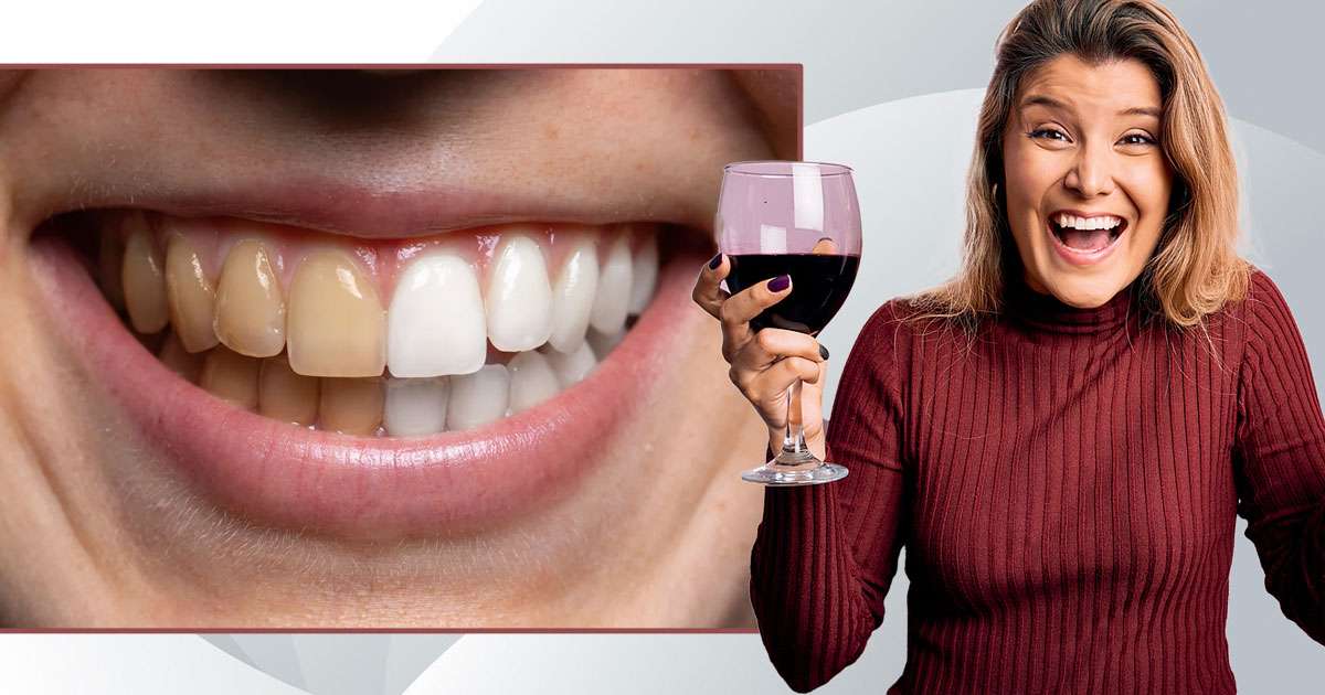does red wine stain teeth