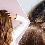 how to exfoliate scalp