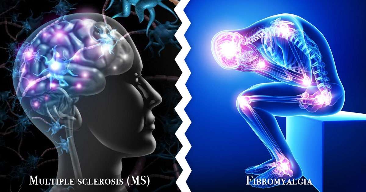 multiple-sclerosis-vs-fibromyalgia